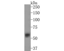 Invitrogen MEF2A/MEF2C Recombinant Rabbit Monoclonal Antibody (JE63-26)