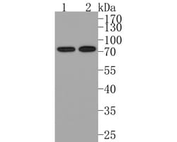 Invitrogen BLNK Recombinant Rabbit Monoclonal Antibody (JE63-50) 100 &mu;L | Buy Online | Invitrogen&trade; | Fisher Scientific
