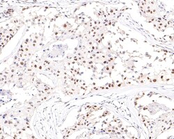 Invitrogen NUP50 Recombinant Rabbit Monoclonal Antibody (JE63-92) 100 &mu;L | Buy Online | Invitrogen&trade; | Fisher Scientific