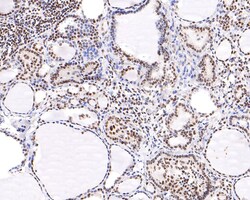 Invitrogen NUP50 Recombinant Rabbit Monoclonal Antibody (JE63-92) 100 &mu;L | Buy Online | Invitrogen&trade; | Fisher Scientific