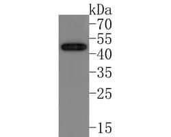 Invitrogen SSTR3 Recombinant Rabbit Monoclonal Antibody (JE63-87) 100 &mu;L;