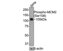 Invitrogen Phospho-MCM2 (Ser108) Recombinant Rabbit Monoclonal Antibody (JE63-52) 100 &mu;L | Buy Online | Invitrogen&trade; | Fisher Scientific