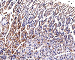 Invitrogen CLPX Recombinant Rabbit Monoclonal Antibody (JE62-96) 100 &mu;L | Buy Online | Invitrogen&trade; | Fisher Scientific