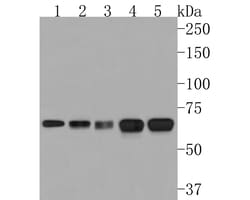 Invitrogen CLPX Recombinant Rabbit Monoclonal Antibody (JE62-96) 100 &mu;L | Buy Online | Invitrogen&trade; | Fisher Scientific