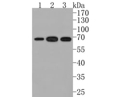 Invitrogen CLPX Recombinant Rabbit Monoclonal Antibody (JE62-96) 100 &mu;L | Buy Online | Invitrogen&trade; | Fisher Scientific