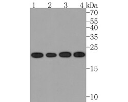 Invitrogen RAB5C Recombinant Rabbit Monoclonal Antibody (JE63-14) 100 &mu;L | Buy Online | Invitrogen&trade; | Fisher Scientific