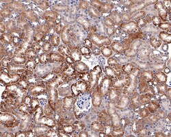 Invitrogen ATG4A Recombinant Rabbit Monoclonal Antibody (JE32-31) 100 &mu;L;