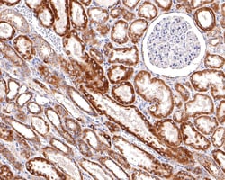Invitrogen STOML2 Recombinant Rabbit Monoclonal Antibody (JE63-15) 100