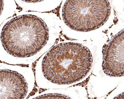 Invitrogen STOML2 Recombinant Rabbit Monoclonal Antibody (JE63-15) 100