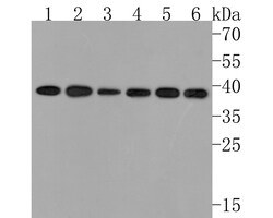 Invitrogen STOML2 Recombinant Rabbit Monoclonal Antibody (JE63-15) 100