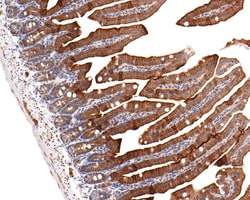 Invitrogen GNA13 Recombinant Rabbit Monoclonal Antibody (JE63-76) 100 &mu;L;