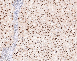 Invitrogen&trade;&nbsp;HNF4A Recombinant Rabbit Monoclonal Antibody (JE63-17)