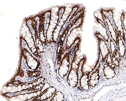Invitrogen HNF4A Recombinant Rabbit Monoclonal Antibody (JE63-17) 100 &mu;L | Buy Online | Invitrogen&trade; | Fisher Scientific