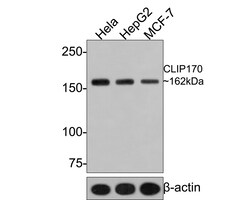 Invitrogen CLIP1 Recombinant Rabbit Monoclonal Antibody (JE63-82) 100 &mu;L;