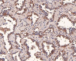 CTPS Recombinant Rabbit Monoclonal Antibody (JE63-85), Invitrogen 100 &mu;L;