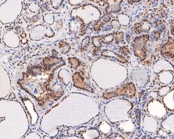 Invitrogen TCEB2 Recombinant Rabbit Monoclonal Antibody (JE65-72) 100 &mu;L;