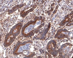 Invitrogen BIN1 Recombinant Rabbit Monoclonal Antibody (JE34-92) 100 &mu;L;