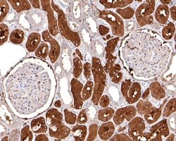 Invitrogen BIN1 Recombinant Rabbit Monoclonal Antibody (JE34-92) 100 &mu;L;