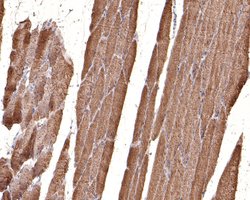 Invitrogen BIN1 Recombinant Rabbit Monoclonal Antibody (JE34-92) 100 &mu;L;