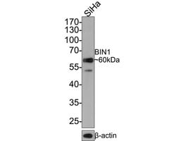 Invitrogen BIN1 Recombinant Rabbit Monoclonal Antibody (JE34-92) 100 &mu;L;