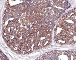 Invitrogen TRPV5 Recombinant Rabbit Monoclonal Antibody (JE62-37) 100 &mu;L;