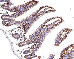 Invitrogen TRPV5 Recombinant Rabbit Monoclonal Antibody (JE62-37) 100 &mu;L;