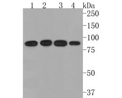 Invitrogen TRPV5 Recombinant Rabbit Monoclonal Antibody (JE62-37) 100 &mu;L;