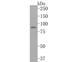Invitrogen TRPV5 Recombinant Rabbit Monoclonal Antibody (JE62-37) 100 &mu;L;
