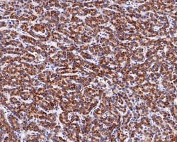 Invitrogen MUT Recombinant Rabbit Monoclonal Antibody (JE62-36) 100 &mu;L;