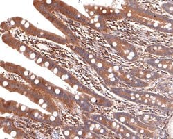 Invitrogen ALDH16A1 Recombinant Rabbit Monoclonal Antibody (JE62-68) 100