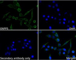Invitrogen ENPP5 Recombinant Rabbit Monoclonal Antibody (JE62-55) 100 &mu;L;