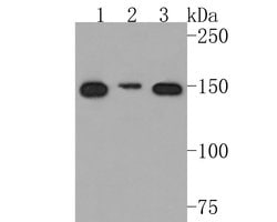 Invitrogen NCAPD2 Recombinant Rabbit Monoclonal Antibody (JE62-22) 100