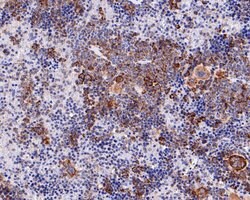Invitrogen SCP2 Recombinant Rabbit Monoclonal Antibody (JE62-79) 100 &mu;L | Buy Online | Invitrogen&trade; | Fisher Scientific
