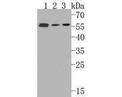 Invitrogen SCP2 Recombinant Rabbit Monoclonal Antibody (JE62-79) 100 &mu;L | Buy Online | Invitrogen&trade; | Fisher Scientific