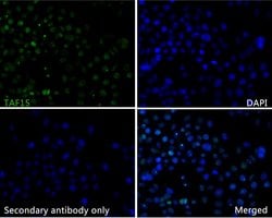 Invitrogen TAF15 Recombinant Rabbit Monoclonal Antibody (JE61-92) 100 &mu;L;