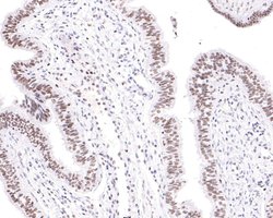 Invitrogen TAF15 Recombinant Rabbit Monoclonal Antibody (JE61-92) 100 &mu;L;