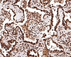 Invitrogen TAF15 Recombinant Rabbit Monoclonal Antibody (JE61-92) 100 &mu;L;