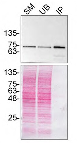 Invitrogen TAF15 Recombinant Rabbit Monoclonal Antibody (JE61-92) 100 &mu;L;