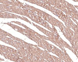 Invitrogen alpha-1a Adrenergic Receptor Recombinant Rabbit Monoclonal Antibody