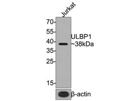 Invitrogen ULBP1 Recombinant Rabbit Monoclonal Antibody (JE65-75) 100 &mu;L;