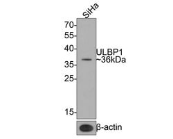 Invitrogen ULBP1 Recombinant Rabbit Monoclonal Antibody (JE65-75) 100 &mu;L;