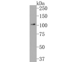 Invitrogen RIG-I Recombinant Rabbit Monoclonal Antibody (JE60-05) 100 &mu;L;