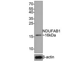 Invitrogen NDUFAB1 Recombinant Rabbit Monoclonal Antibody (JE65-76) 100