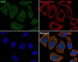 Invitrogen NMI Recombinant Rabbit Monoclonal Antibody (JE65-78) 100 &mu;L;