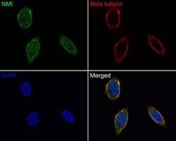 Invitrogen NMI Recombinant Rabbit Monoclonal Antibody (JE65-78) 100 &mu;L;