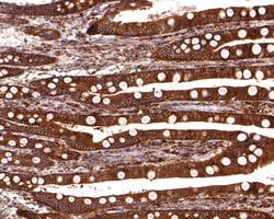 Invitrogen NMI Recombinant Rabbit Monoclonal Antibody (JE65-78) 100 &mu;L;