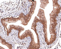 Invitrogen Cystatin B Recombinant Rabbit Monoclonal Antibody (JE63-34)