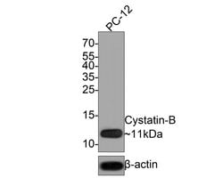 Invitrogen Cystatin B Recombinant Rabbit Monoclonal Antibody (JE63-34)