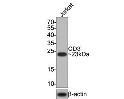 Invitrogen CD3 Recombinant Rabbit Monoclonal Antibody (JE80-02) 100 &mu;L;