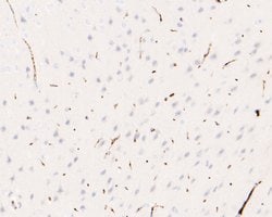 Invitrogen IRAK1 Recombinant Rabbit Monoclonal Antibody (JE60-03) 100 &mu;L;